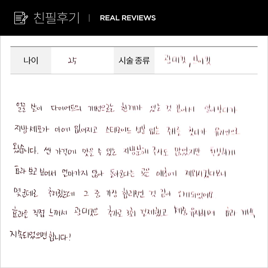 브이컷, 광대컷 후기