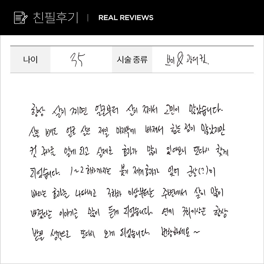 브이컷, 광대컷 후기