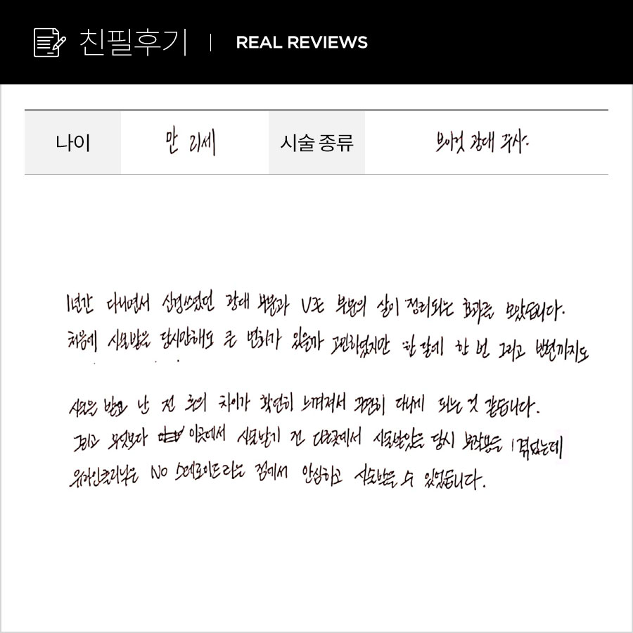 브이컷, 광대컷 후기