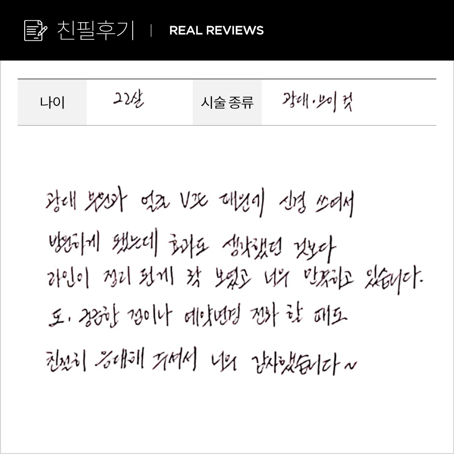 브이컷, 광대컷 후기