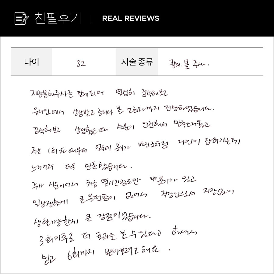 브이컷, 광대컷 후기