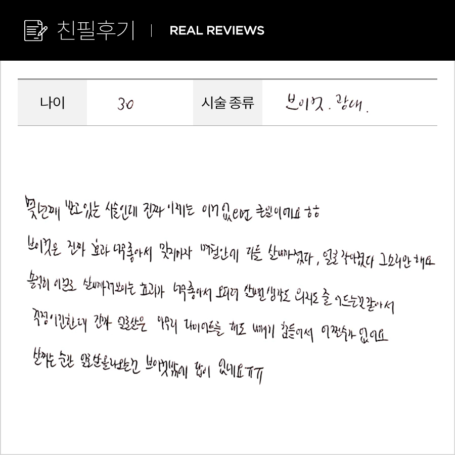브이컷, 광대컷 후기