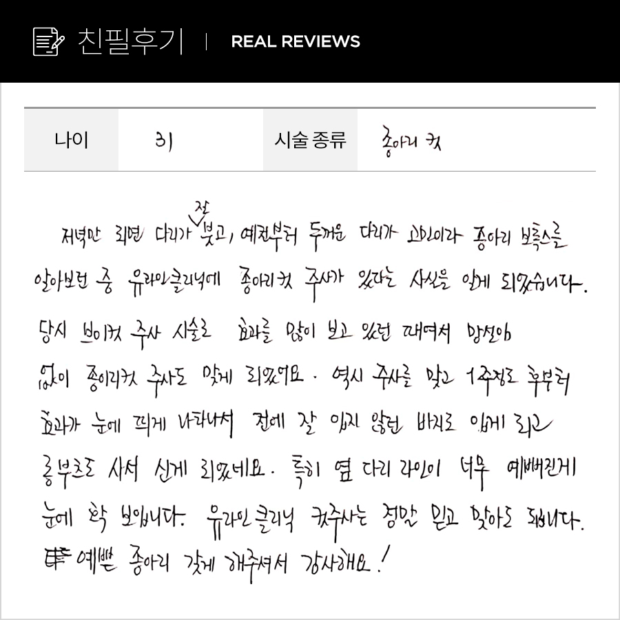종아리컷 후기