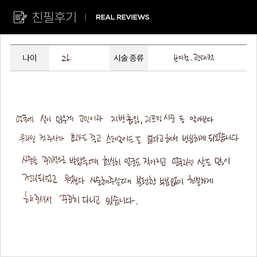 브이컷, 광대컷 후기