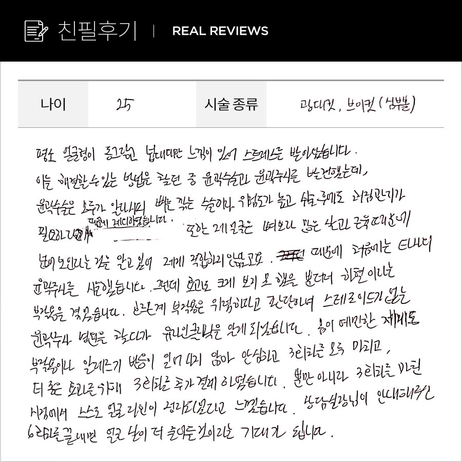 광대,브이 후기