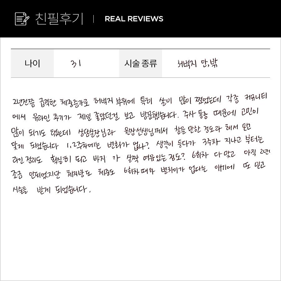 허벅지컷 후기