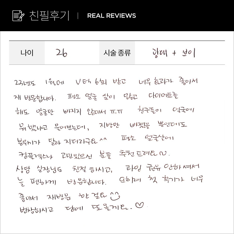 광대,브이컷 후기