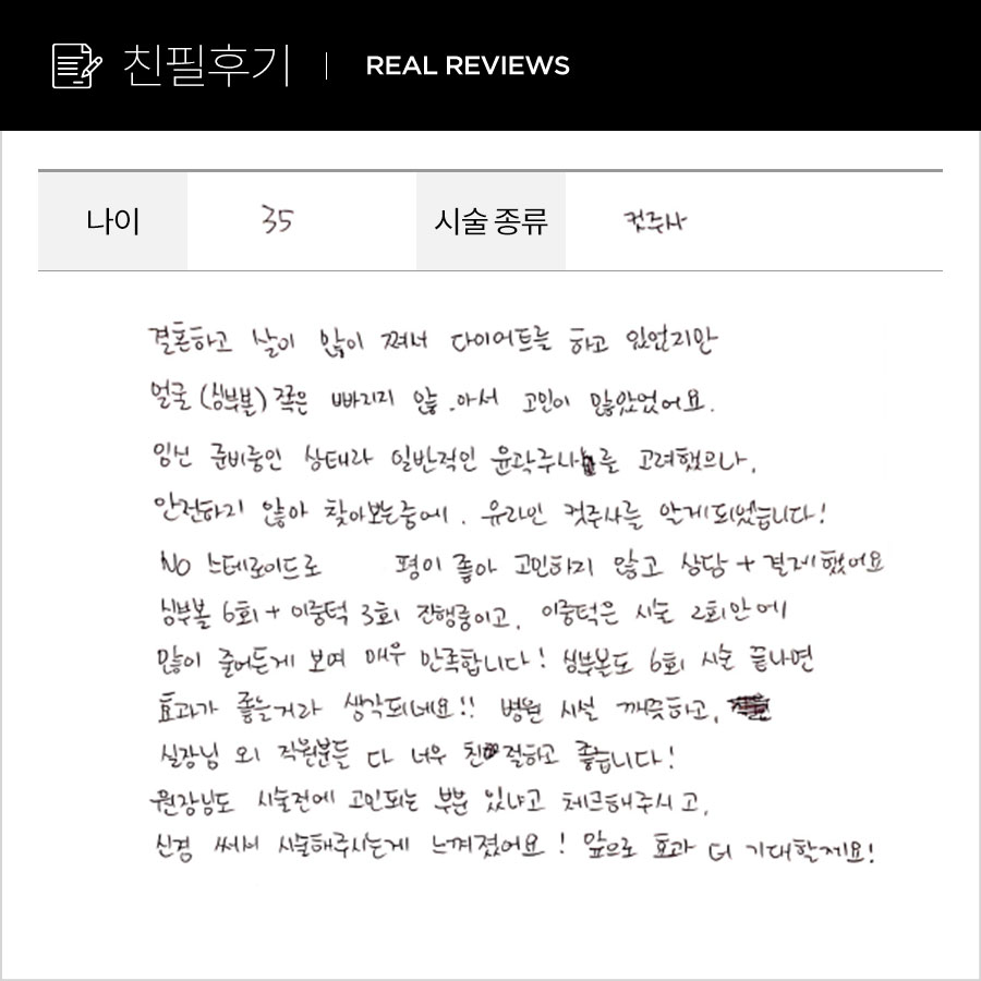 페이스컷 후기