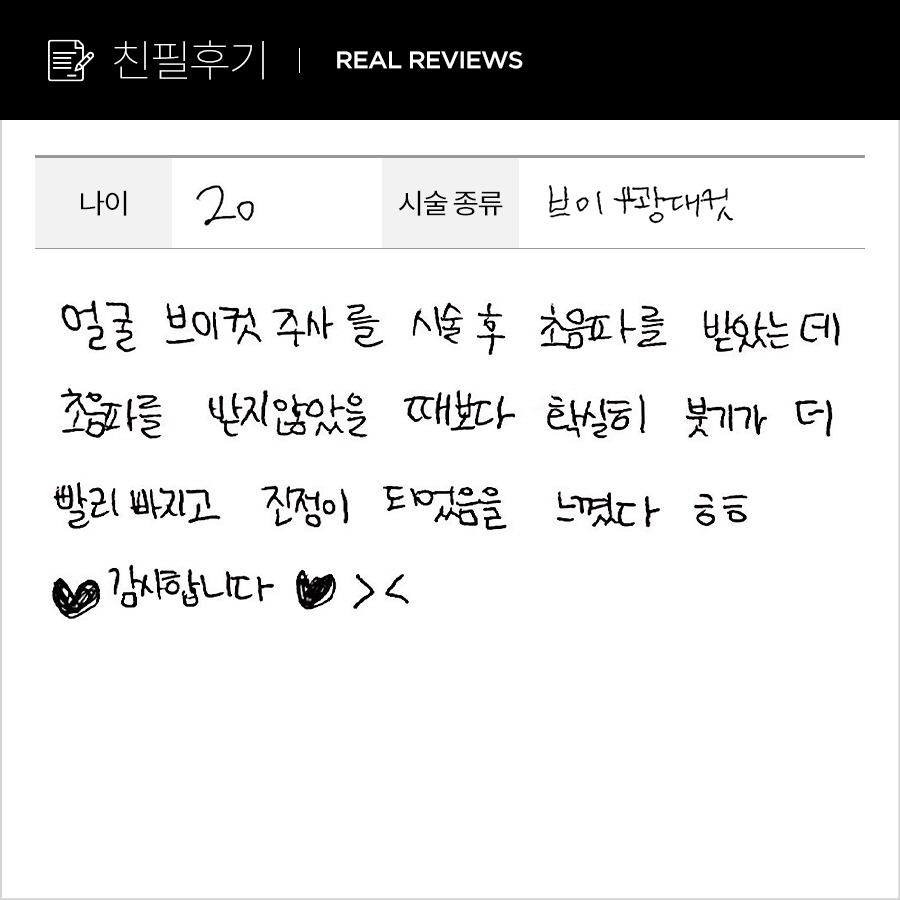 브이, 광대컷 후기