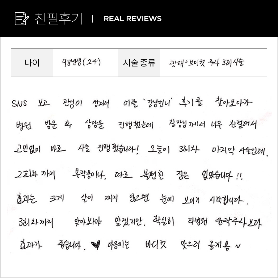 브이컷, 광대컷 후기