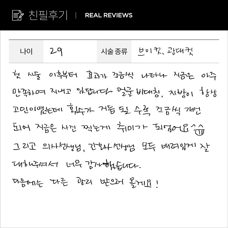 브이, 광대컷 후기