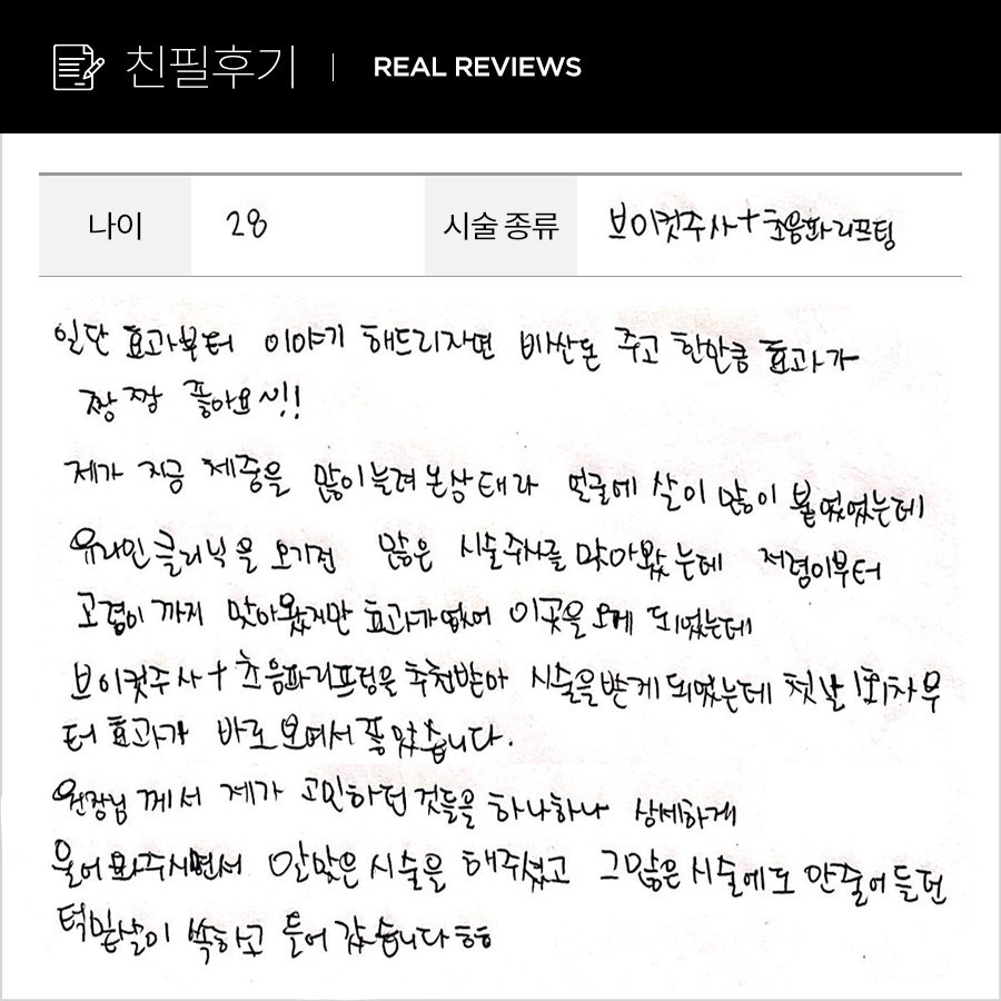 브이컷, 리프팅 후기