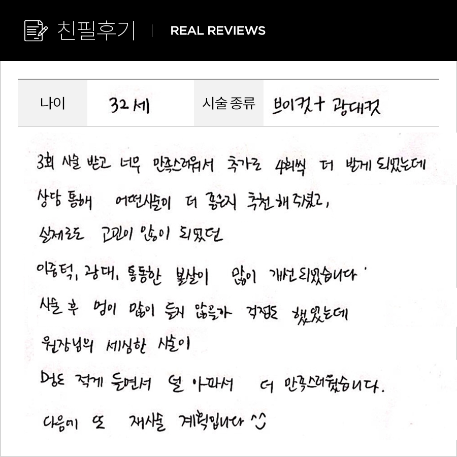 브이컷, 광대컷 후기
