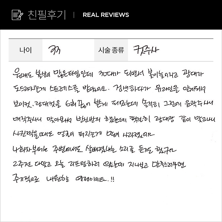 브이, 광대컷 후기