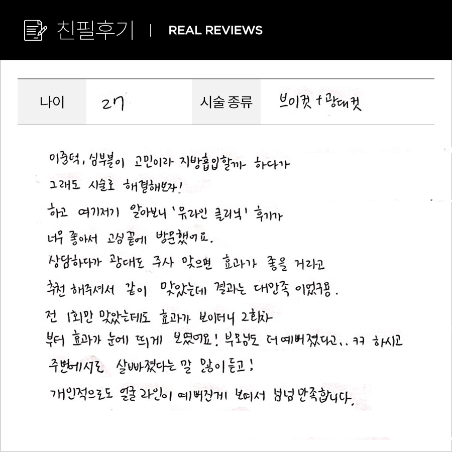 브이컷, 광대컷 후기