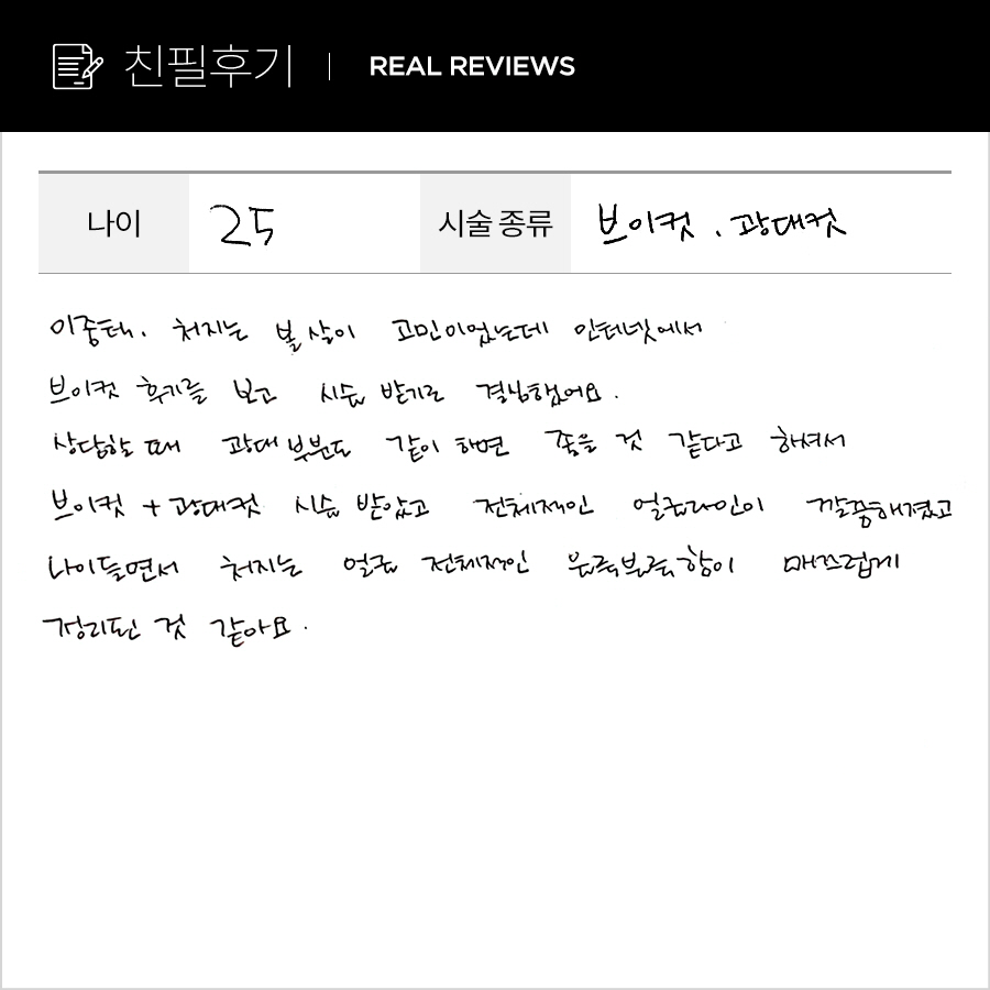 브이컷, 광대컷 후기