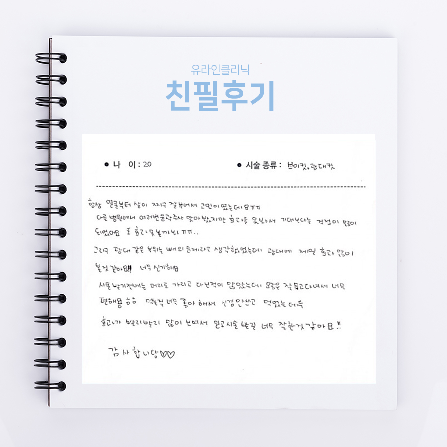 브이컷, 광대컷 후기