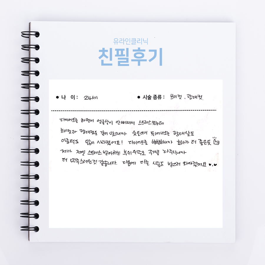 브이컷, 광대컷 후기