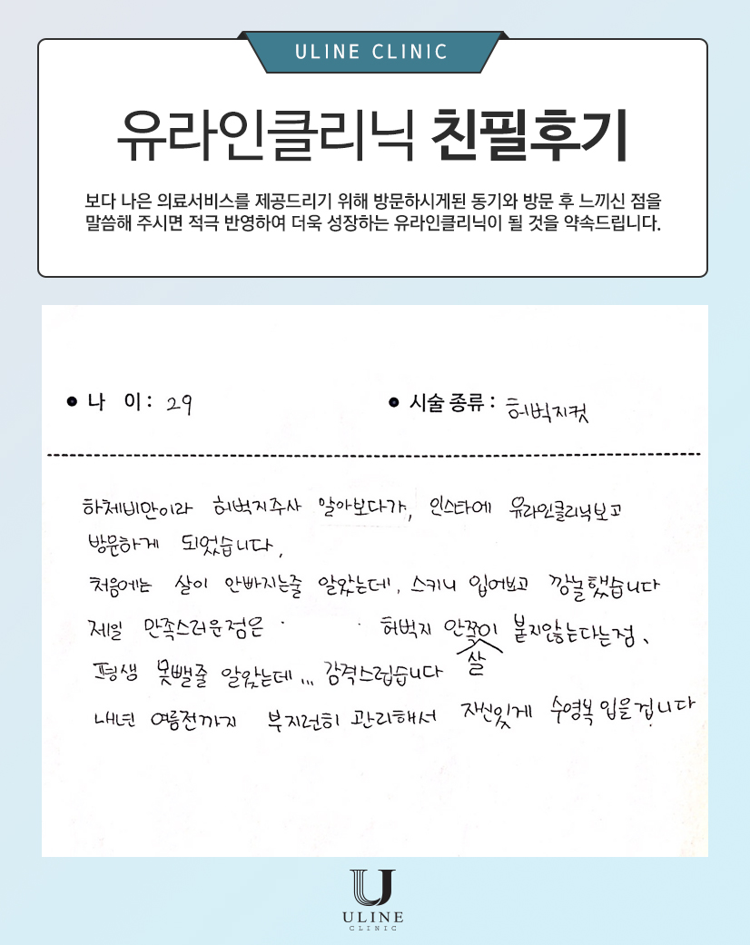 공OO님의 허벅지컷 후기