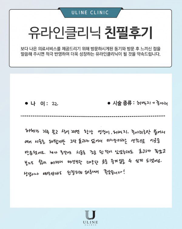 최○○님의 허벅지 컷주사 후기