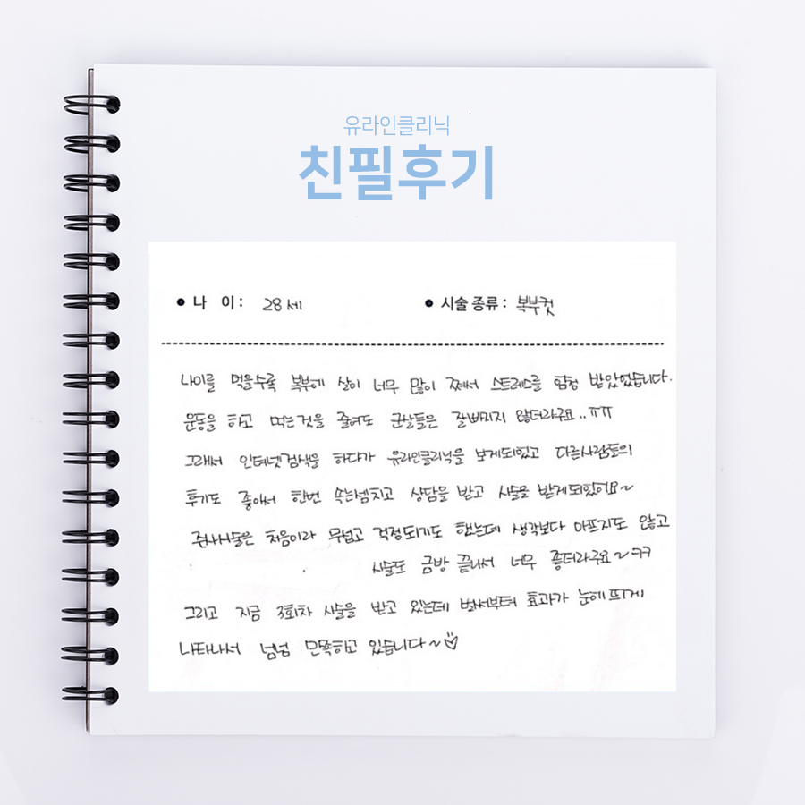 복부컷 후기