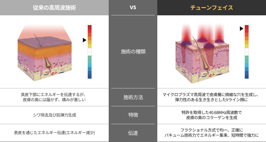 チューンフェイスと従来の高周波の比較