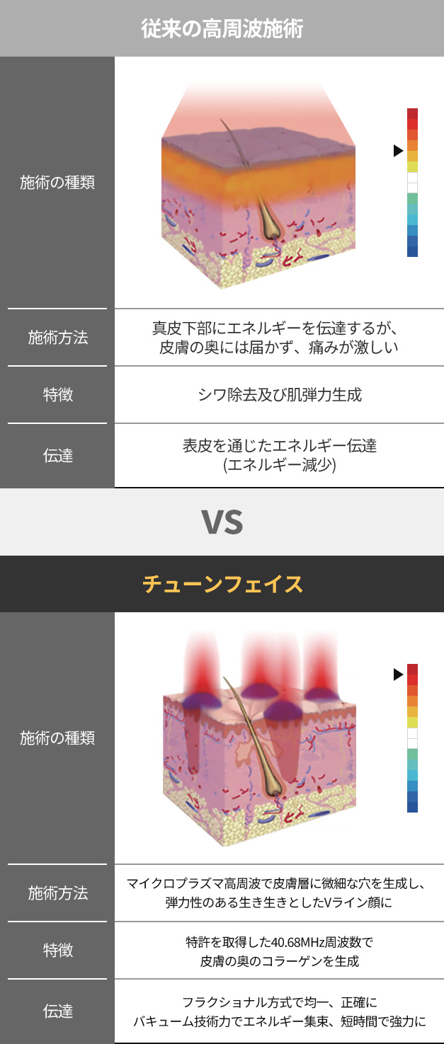 チューンフェイスと従来の高周波の比較